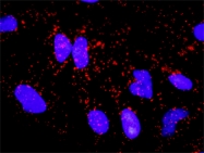 H00004747-D01P - Neurofilament L (68kDa)