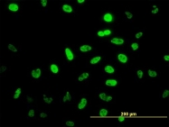 H00004760-M01 - NEUROD1