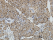 H00004760-M02 - NEUROD1