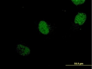 H00004762-M06 - Neurogenin 1