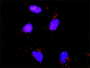 H00004790-M01 - NF-kB p105 / p50