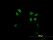 H00004793-B01 - NFKBIB / IKBB