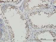 H00004802-M01 - NFYC