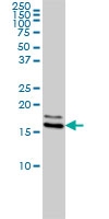 H00004830-M01 - NDP kinase A