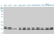 H00004830-M02 - NDP kinase A