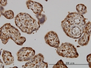 H00004830-M02 - NDP kinase A