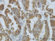 H00004838-M03 - NODAL