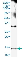 H00004867-D01 - Nephrocystin 1