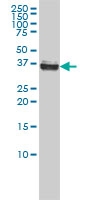 H00004869-M01 - Nucleophosmin