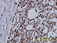 H00004869-M01 - Nucleophosmin