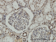 H00004899-M01 - NRF1