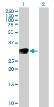H00004908-D01P - Neurotrophin 3 / NTF3