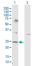 H00004909-D01P - Neurotrophin 4 / NTF4
