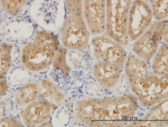 H00004952-M02 - OCRL