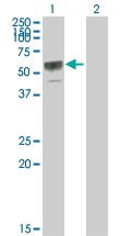 H00004982-B02P - Osteoprotegerin / TNFRSF11B