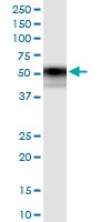 H00004982-D01 - Osteoprotegerin / TNFRSF11B