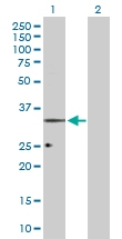 H00004987-D01P - Nociceptin receptor / OPRL1