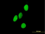 H00005000-B01 - ORC4