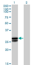 H00005008-B02P - Oncostatin-M