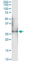 H00005008-D01 - Oncostatin-M