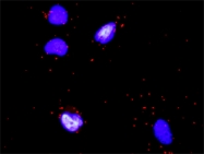 H00005008-D01P - Oncostatin-M