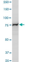 H00005046-A01 - PCSK6 / PACE4