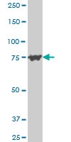 H00005046-A01 - PCSK6 / PACE4