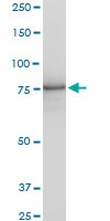 H00005046-A01 - PCSK6 / PACE4