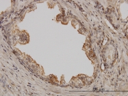 H00005058-M01 - PAK1
