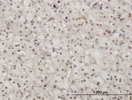 H00005076-M01 - PAX2