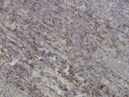 H00005079-M01 - PAX5