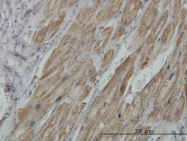 H00005162-M03 - PDHB