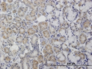 H00005164-M01 - PDK2