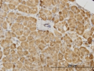 H00005164-M02 - PDK2
