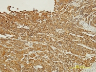 H00005174-M01 - PDZD1