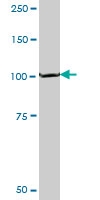 H00005190-M04 - Peroxin 6 / PEX6