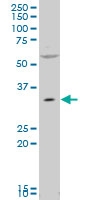 H00005191-A01 - Peroxin 7 / PEX7