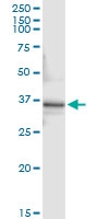 H00005192-D01 - Peroxin 10 / PEX10 / RNF69
