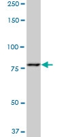 H00005213-M04 - PFKM