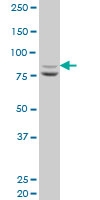 H00005214-A01 - PFKP