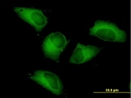 H00005214-B01 - PFKP