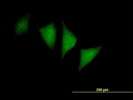 H00005218-B01P - PFTK1 / CDK14