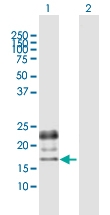 H00005228-B01P - Placenta growth factor / PGF