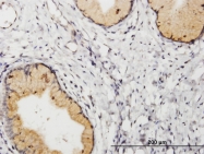 H00005228-B01P - Placenta growth factor / PGF