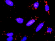 H00005228-D01P - Placenta growth factor / PGF