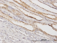 H00005229-M02 - PGGT1B