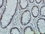 H00005238-M01 - PGM3