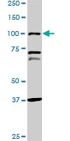H00005241-M07 - Progesterone receptor