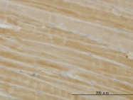H00005260-M02 - PHKG1 / PHKG