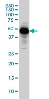 H00005274-M01 - Neuroserpin / SERPINI1